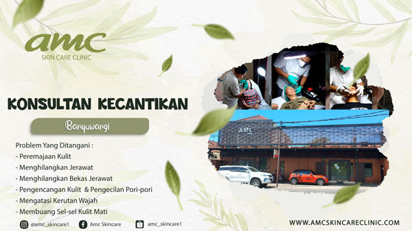 konsultan kecantikan banyuwangi
