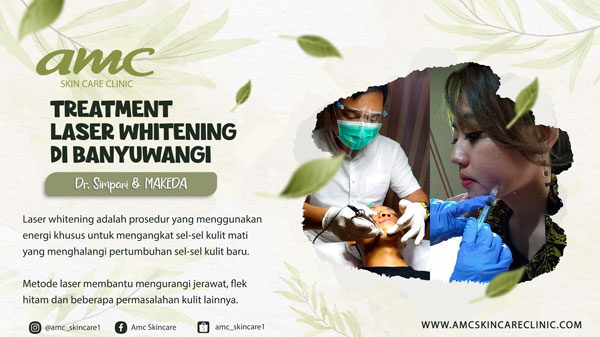 Laser Whitening Banyuwangi
